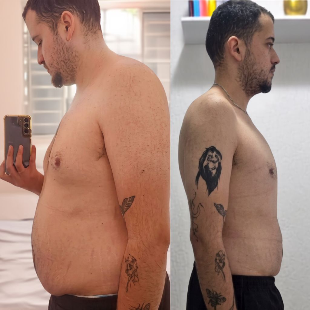 Transformação Dennis